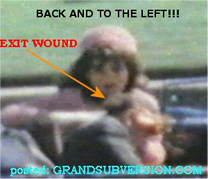 jfk assassination kennedy photo lone gunman lee harvey oswald head shot wound