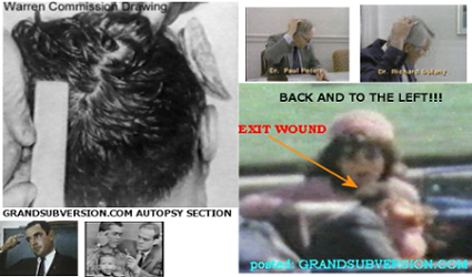jfk kennedy assassination photo picture head shot wound autopsy