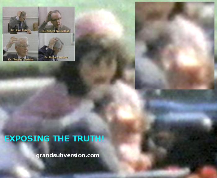 CONSPIRACY THEORIES JFK KENNEDY ASSASSINATION head explosion photos graphic