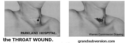 jfk throat neck wound autopsy photos assassination kennedy john f conspiracy pic picture bullet shot from front or back