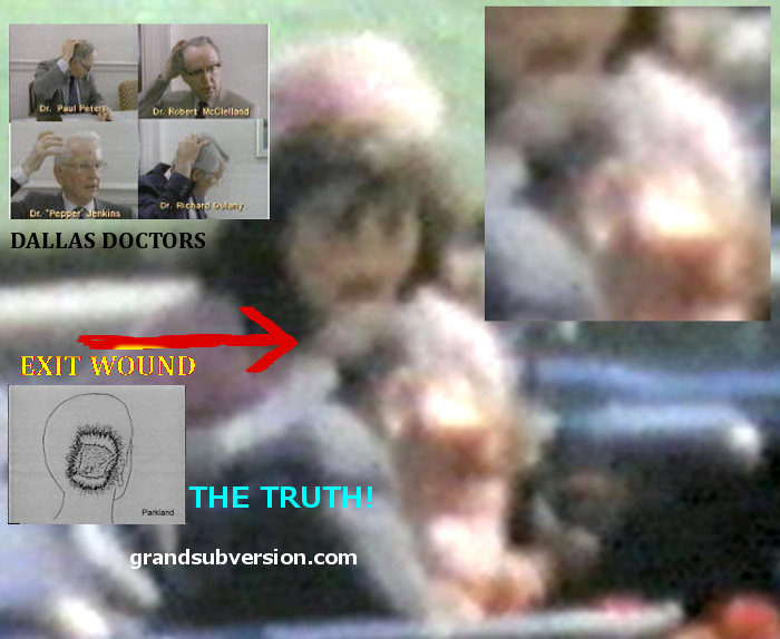 ZAPRUDER FILM FRAME 313 336 photo image close up jfk assassination