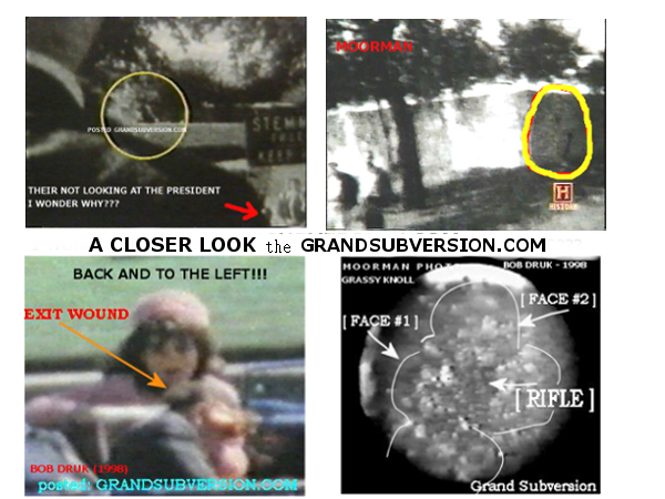 jfk assassination kennedy photos pictures head shot autopsy john f WHO KILLED 2nd shooters 