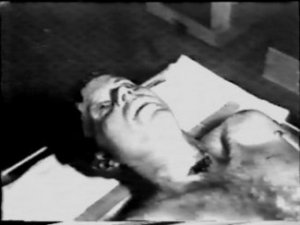 autopsy jfk kennedy assassination photos photographs pictures pic bethesda 01