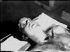 autopsy photo jfk kennedy assassination picture pic bethesda 01