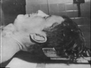 jfk autopsy picture john f kennedy assassination head wound photos bethesda 03